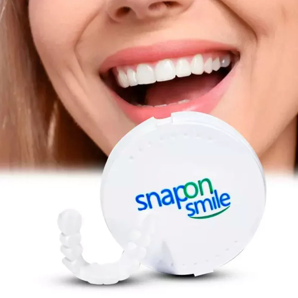 Carillas dentales - Snap on Smile